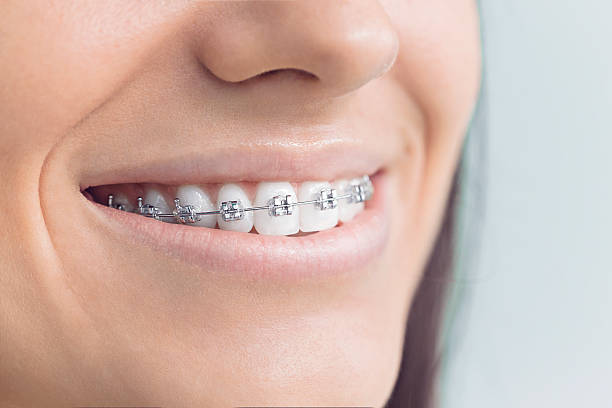 Trusted Abbotsford, WI Dental Services Experts